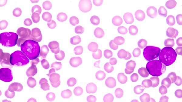 感染鼻病毒需要隔离吗