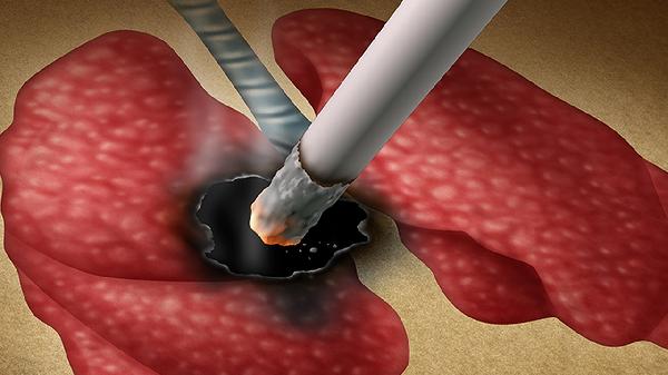 吸烟为何会增加患肺癌风险