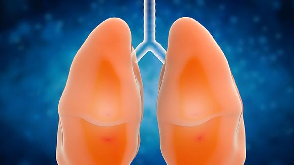 肺气肿肺大泡会传染吗到底会不会传染