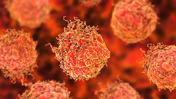 肺淋巴管肌瘤是不是癌症能治好吗