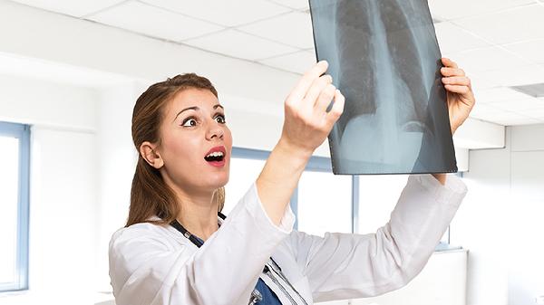 肺水肿到底是什么原因造成的