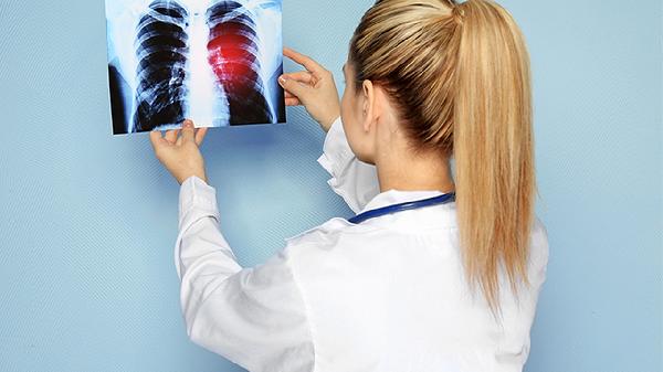 支原体和衣原体肺炎有哪些典型症状表现