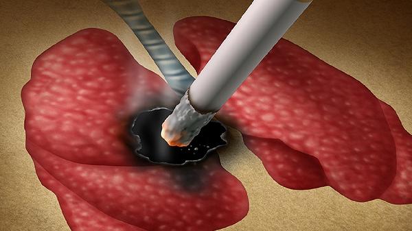 不吸烟的人也会得肺癌吗