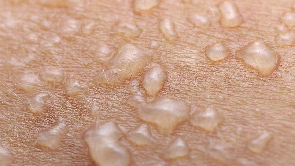 外伤导致蛛网膜下腔少量出血要多久才能恢复健康