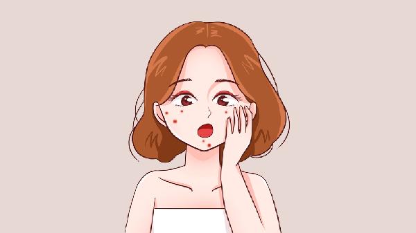 嘴巴周围为什么总长痘痘