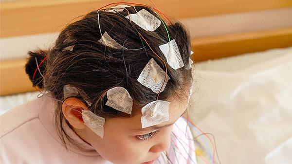 小儿脑神经损伤有哪些有效药物治疗方案