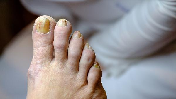 足弓痛是怎么引起的