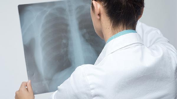 怎样处理肺部结节的治疗介入方式