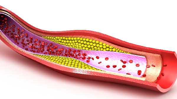周围血管超声是什么意思及如何应用