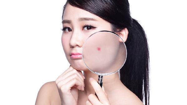 青春期长粉刺怎么有效改善