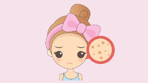 去除雀斑的实用方法有哪些