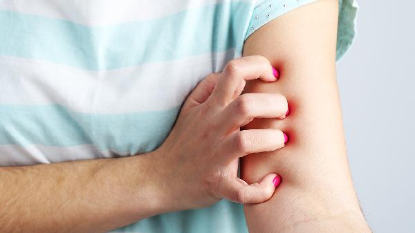 皮肤瘙痒用什么药效果好