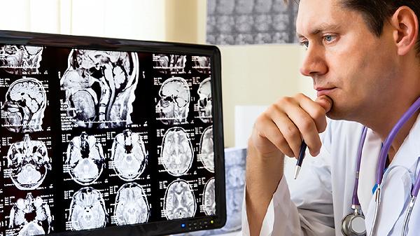 脑血栓怎么治才能有效消除