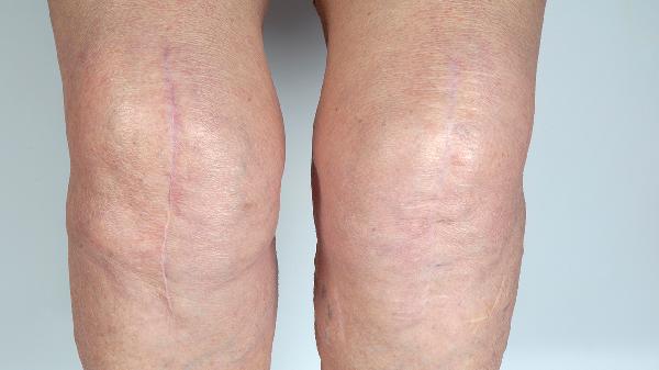 脸浮肿是怎么回事原因有哪些