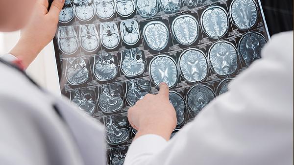 脑溢血患者日常护理指南与保养方法