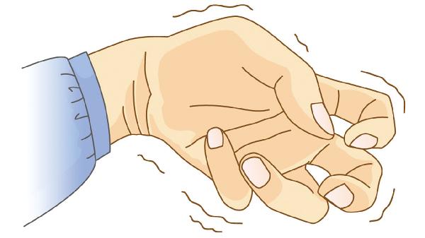 小儿良性癫痫会损害智力吗