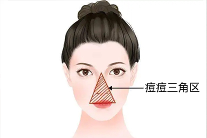 吃这些食物能有效缓解痘痘问题