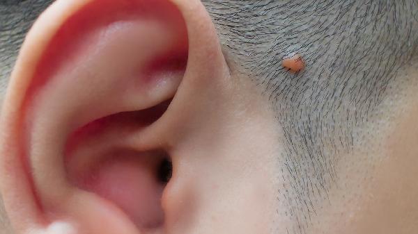 皮肤一抓就更痒了怎么办