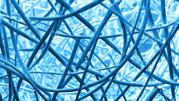 三叉神经痛竟由血管压迫引起